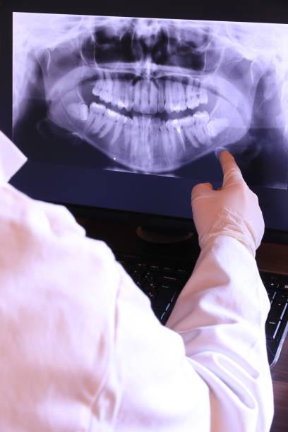 Best Emergency Root Canal Treatment in Norwalk, OH